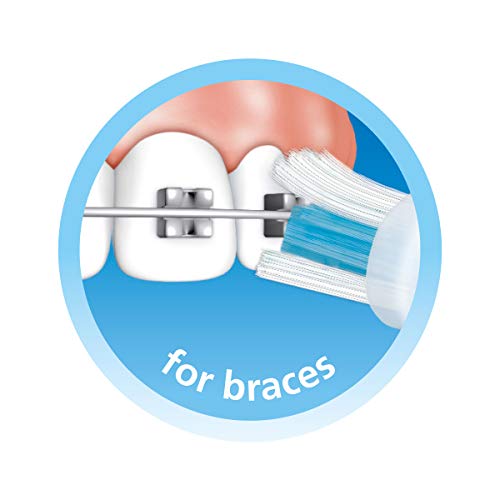 trisa-sonic-performance-bracket-clean-handzahnb-rste-zahnspange image 8